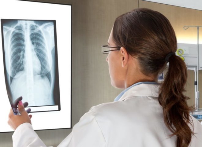 Что показывает рентген легких и бронхов