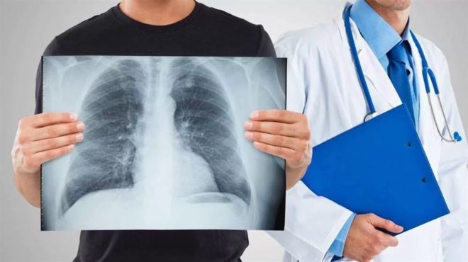 Вредна ли флюорография, противопоказания и как часто можно ее проходить