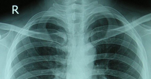 Как часто нужно делать флюорографию