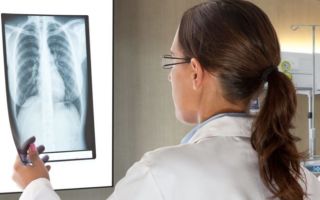 Что показывает рентген легких и бронхов